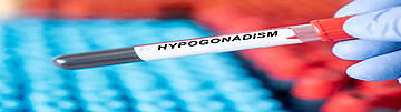 Hypogonadismus - Bluttest zur Diagnose. Urologenzentrum Wien - Hypogonadismus: Blutprobe in einer Testflasche.