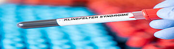 Klinefelter Syndrom - Bluttest zur Diagnose. Urologenzentrum Wien - Klinefelter Syndrom: Blutprobe zur Diagnose des Syndroms.