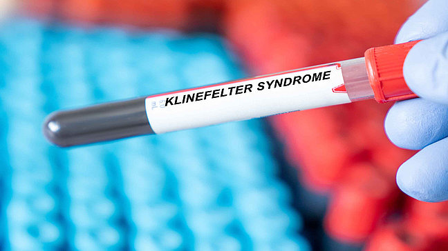 Urologenzentrum Wien - Klinefelter Syndrom: Blutprobe zur Diagnose des Syndroms.