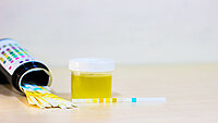 Urologenzentrum Wien - Glucosurie: Urinteststreifen zur Feststellung von Glukose im Urin.