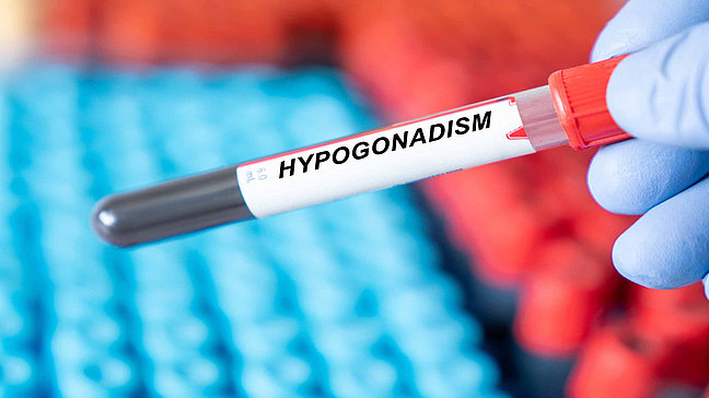 Urologenzentrum Wien - Hypogonadismus: Blutprobe in einer Testflasche.