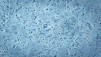 Urologenzentrum Wien - Asthenozoospermie unter einem Mikroskopbild von Spermien.