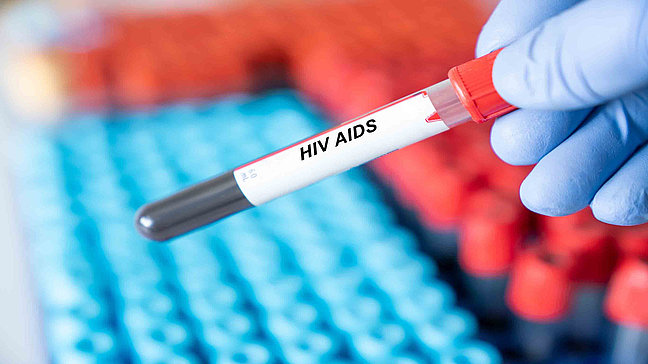 HIV - Bluttest zur HIV/AIDS-Diagnose. Urologenzentrum Wien - HIV: Blutprobe zur Diagnose von HIV/AIDS.